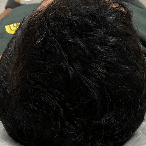 After Image: HairRevive Boost - back
