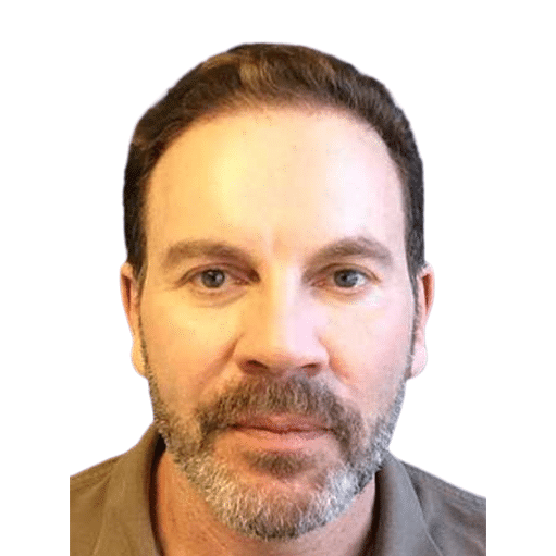 After Image: Hair Transplant - front