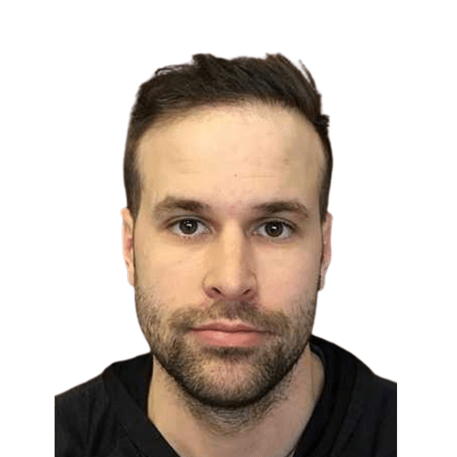After Image: Hair Transplant - front