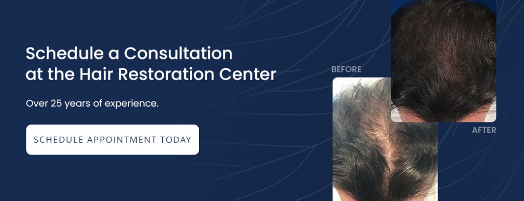 03-schedule-a-consultation-at-the-hair-restoration-center